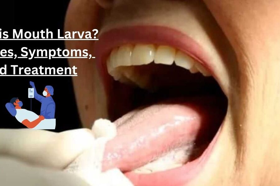 What is Mouth Larva? Causes, Symptoms, and Treatment