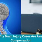 Reasons Why Brain Injury Cases Are Awarded High Compensation