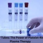 PRP Tubes: The Power of Platelet-Rich Plasma Therapyp