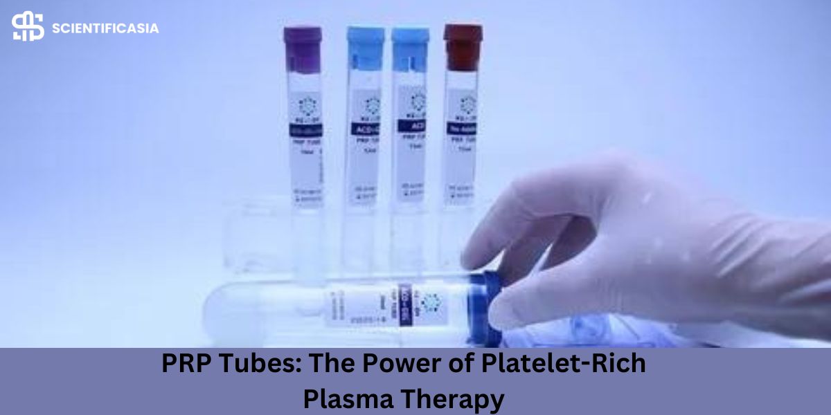 PRP Tubes: The Power of Platelet-Rich Plasma Therapy