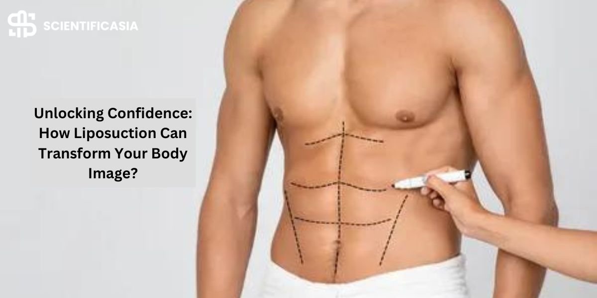 Unlocking Confidence: How Liposuction Can Transform Your Body Image?