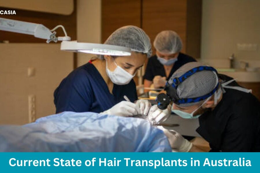 The Current State of Hair Transplants in Australia