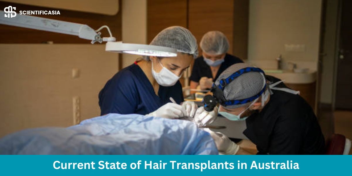The Current State of Hair Transplants in Australia