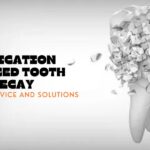 Medication-Induced Tooth Decay: Practical Advice and Solutions