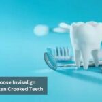 5 Reasons to Choose Invisalign Aligners to Straighten Crooked Teeth