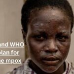 Africa CDC and WHO started a plan for covering the mpox