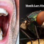 Mouth Larva (Oral Myiasis): Causes, Symptoms, and Treatment