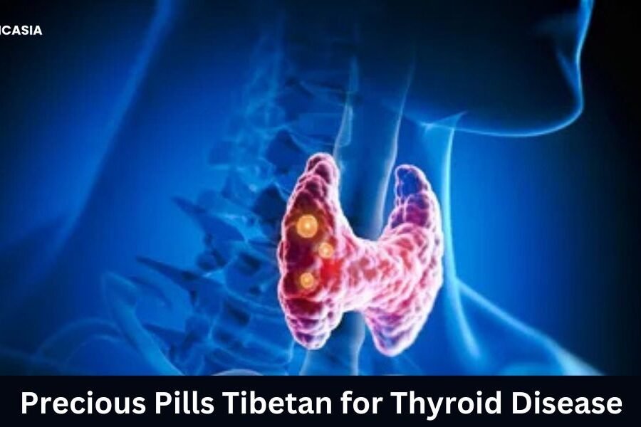 Precious Pills Tibetan for Thyroid Disease: A Comprehensive Guide 