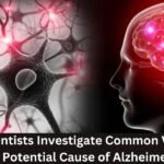 Scientists Investigate Common Virus as Potential Cause of Alzheimer’s