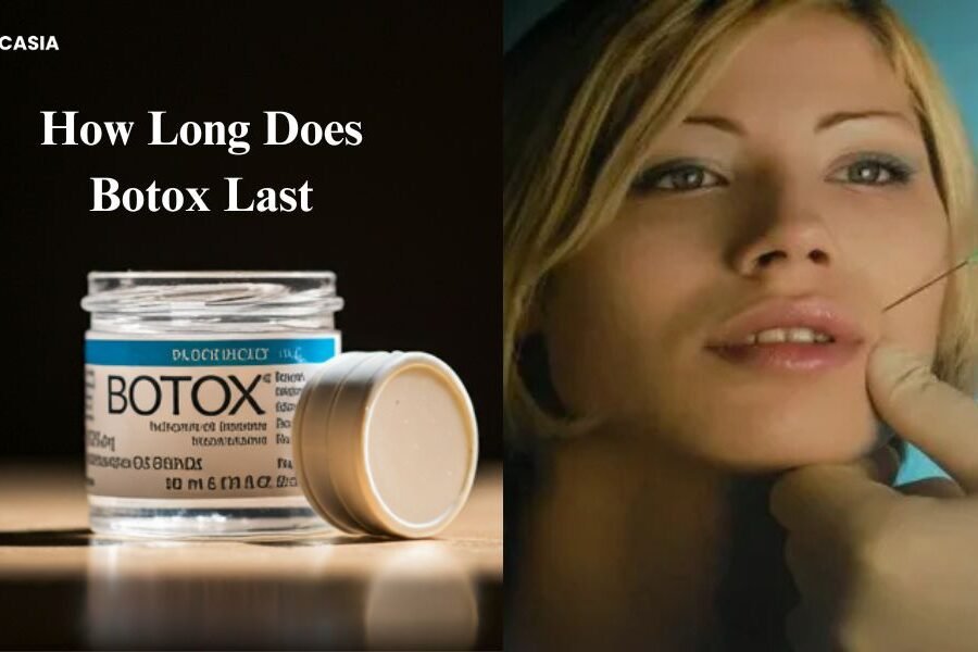 How Long Does Botox Last? Botox Duration Explained