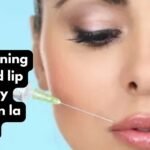 Skin tightening botox and lip fillers by skinsation la price