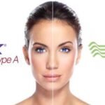 What is the difference between Botox and Dysport?