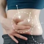 How To Know If You Are A Good Candidate for a Tummy Tuck Surgery