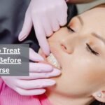 Don’t Ignore the Signs—Here’s How to Treat Gum Disease Before It Gets Worse