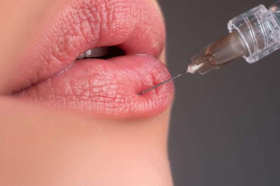 Lip Filler Aftercare: What to Avoid & How to Maintain Long-Lasting Results