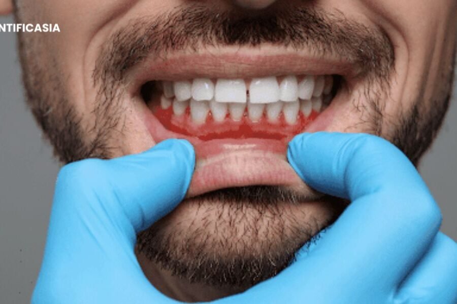 What Causes Staining on Teeth and Gums?