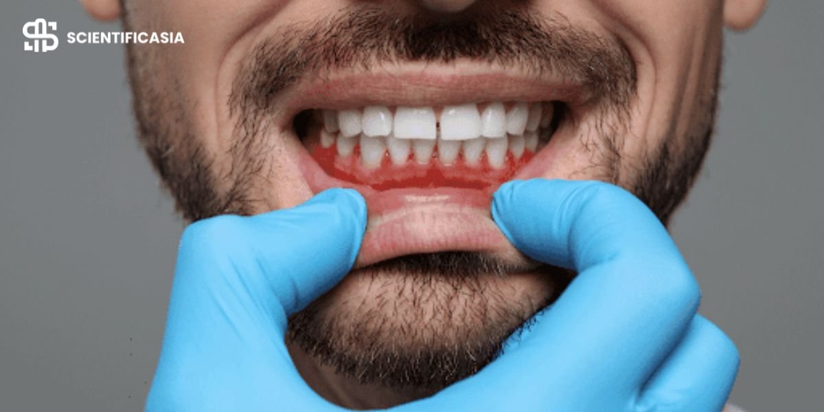 What Causes Staining on Teeth and Gums?
