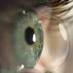 How to Fix Common Ortho-K Lens Issues: A Practical Guide for Parents and Clinics in Australia