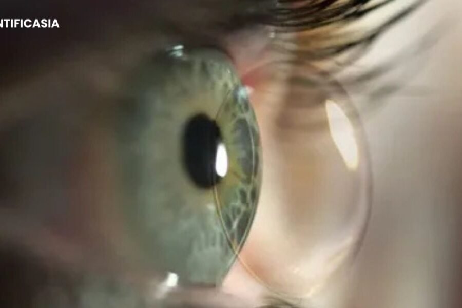 How to Fix Common Ortho-K Lens Issues: A Practical Guide for Parents and Clinics in Australia