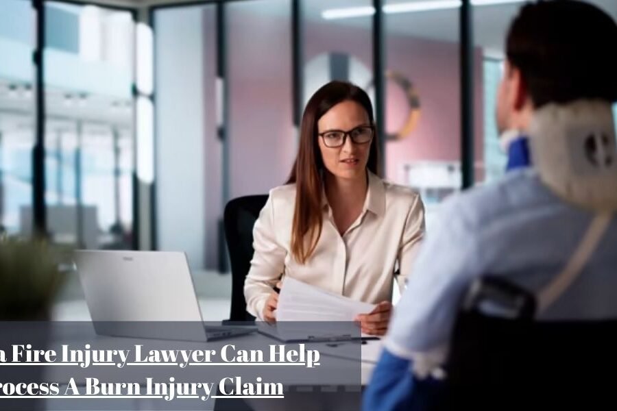 How a Fire Injury Lawyer Can Help Process A Burn Injury Claim