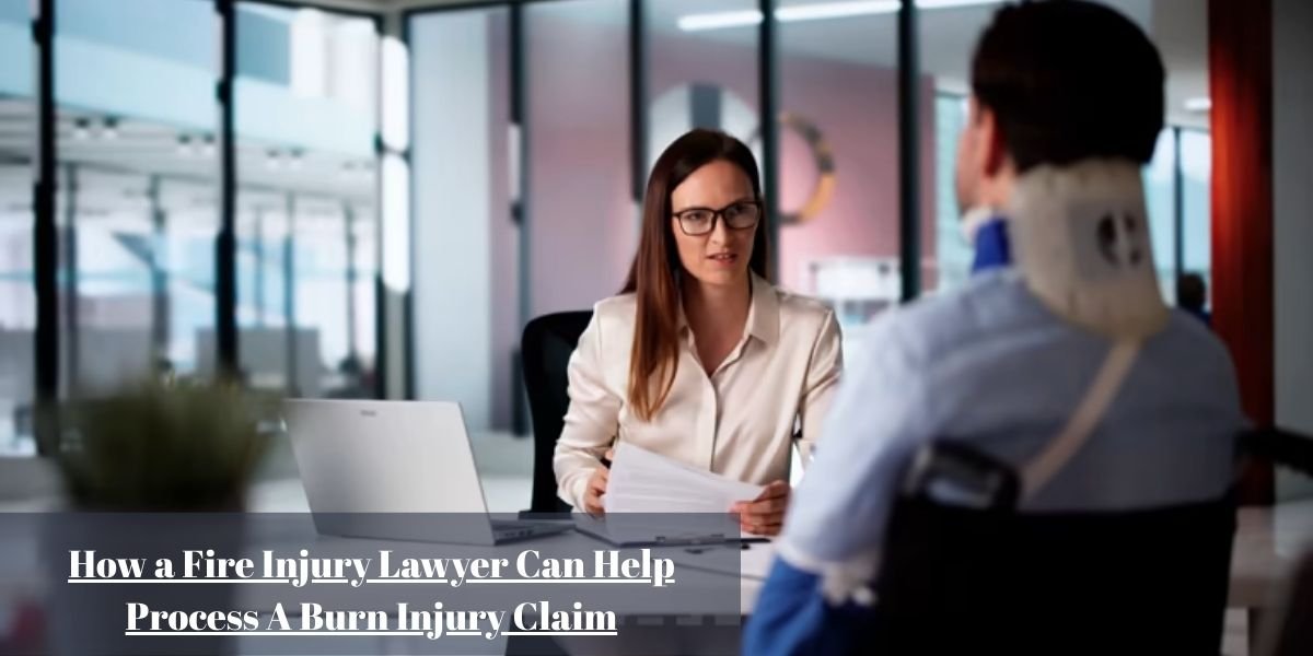 How a Fire Injury Lawyer Can Help Process A Burn Injury Claim